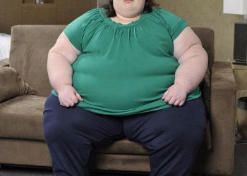 Inilah Penyebab Kelebihan Berat Badan Atau Obesitas