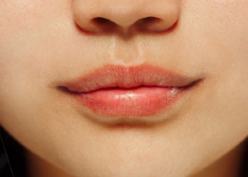 Bibir Kering Puasa