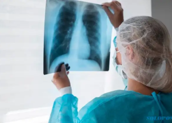 Kasus Mycoplasma Pneumoniae Ditemukan di Indonesia, Ini Antisipasi DKK Solo