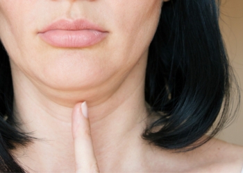 Wajah Terlihat Bengkak karena Face Fat? Yuk, Simak Tips Kesehatan Berikut Ini!